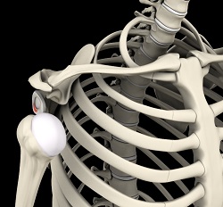 Shoulder Instability Shoulder Instability
