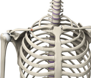 Clavicle Fracture Image Clavicle Fracture