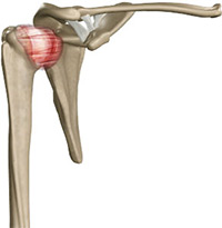 Frozen Shoulder Image Frozen Shoulder