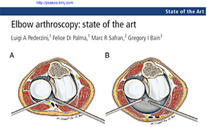 Elbow Arthroscopy