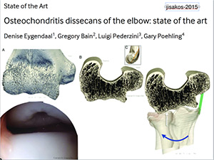 osteochondrosis treatment)